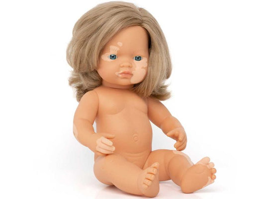 miniland dolls Babypuppe europäisches Mädchen ohne Kleidung, mit Pigmentstörung