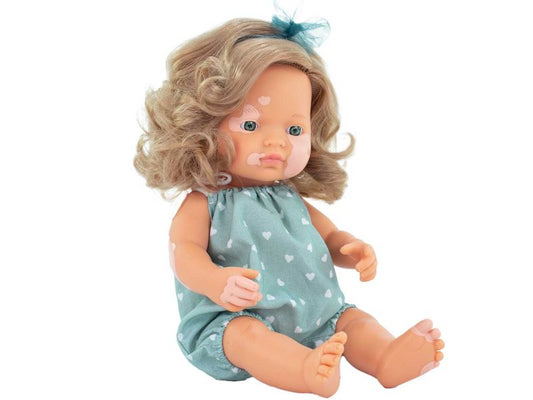 miniland dolls Babypuppe europäisches Mädchen mit Pigmentstörung