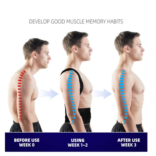 Sandwich Steel Plate Hunchback Posture Correction Strap, Back Corrector, Support And Fixation Strap