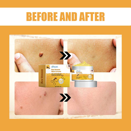 Ximonth Kwart Series Gentle Cleansing, Moisturizing And Desalting Skin Label Skin Care Topical Kow Care