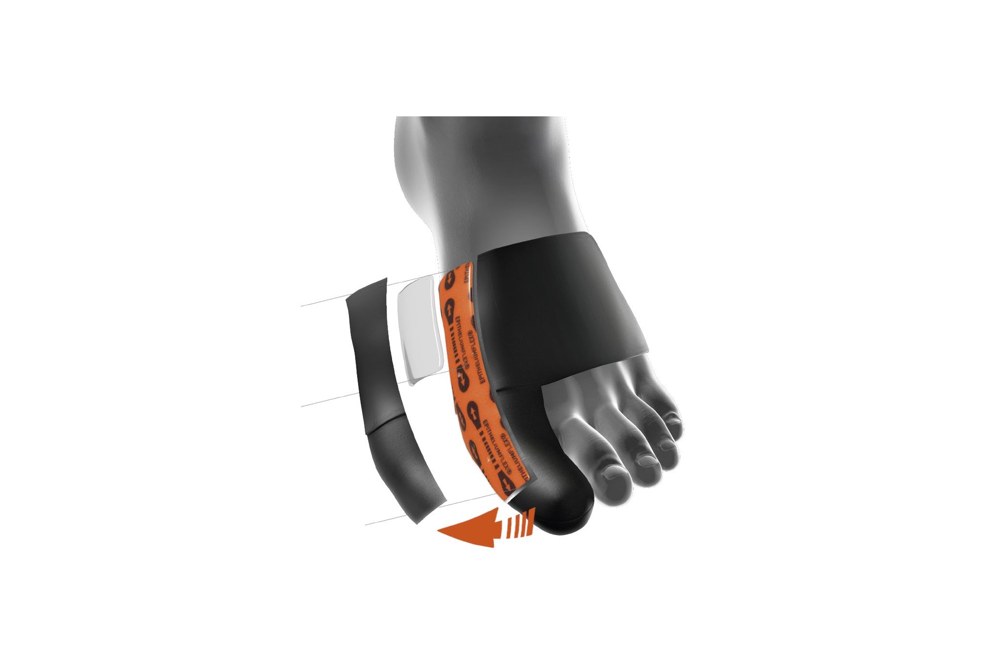 Orthese Hallux Valgus Epithelium Flex 02